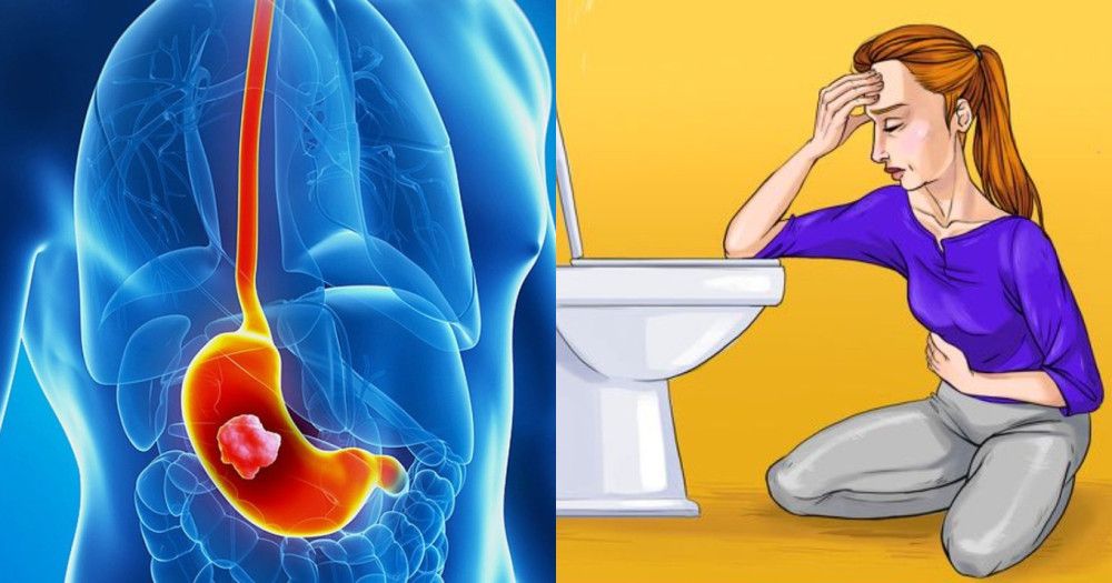 452542 karkinos tou stomachou to sybtoma pou polloi ypotimoun kai chanoun polytimo chrono.jpg