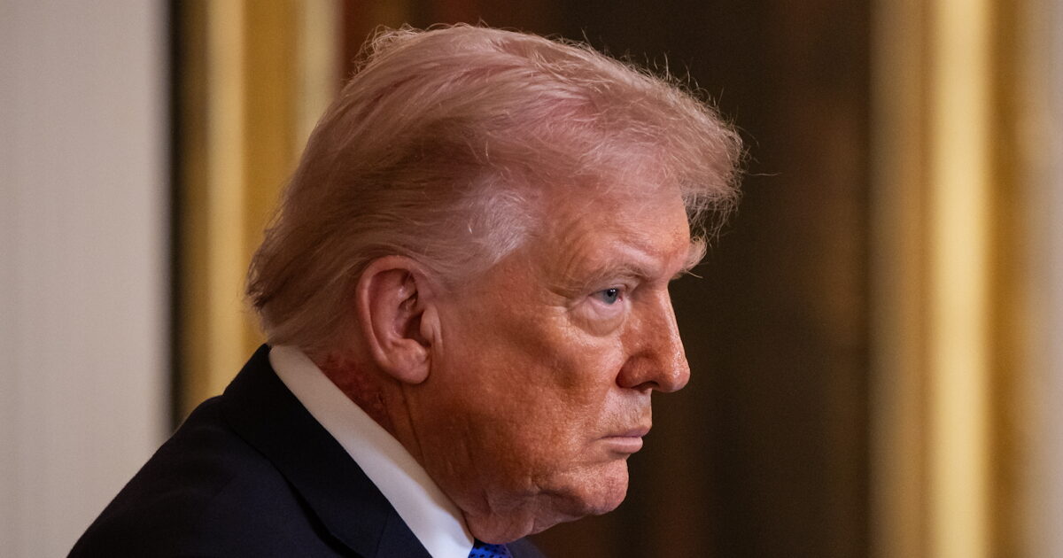 1773499106 trump exzema2 1200x630.jpg