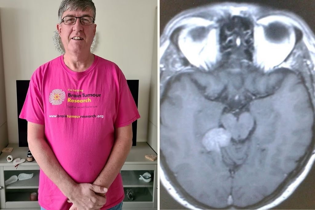 453825 nomiza oti itan aples emvoes i martyria 59chronou pou odigise se diagnosi ogkou ston egkefalo.jpg