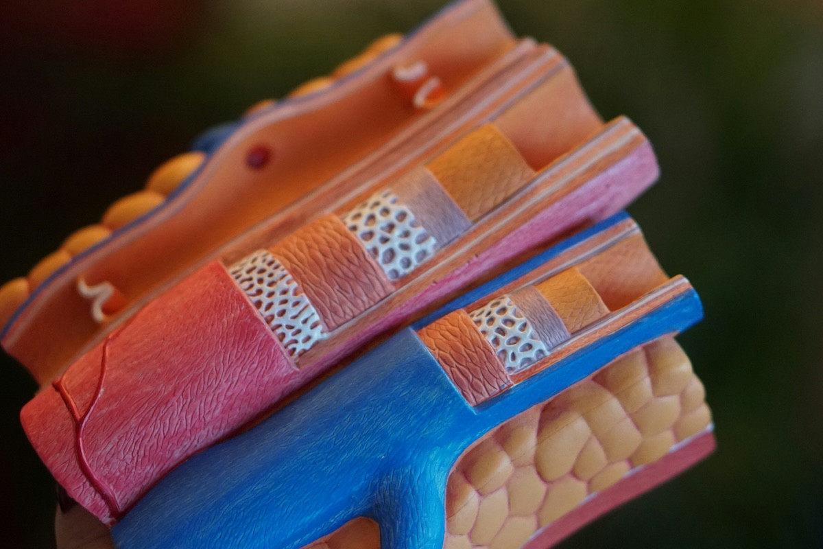 454452 ldl cholisterini poso prepei na meiothei gia chamilotero kindyno emfragmatos kai egkefalikou.jpg