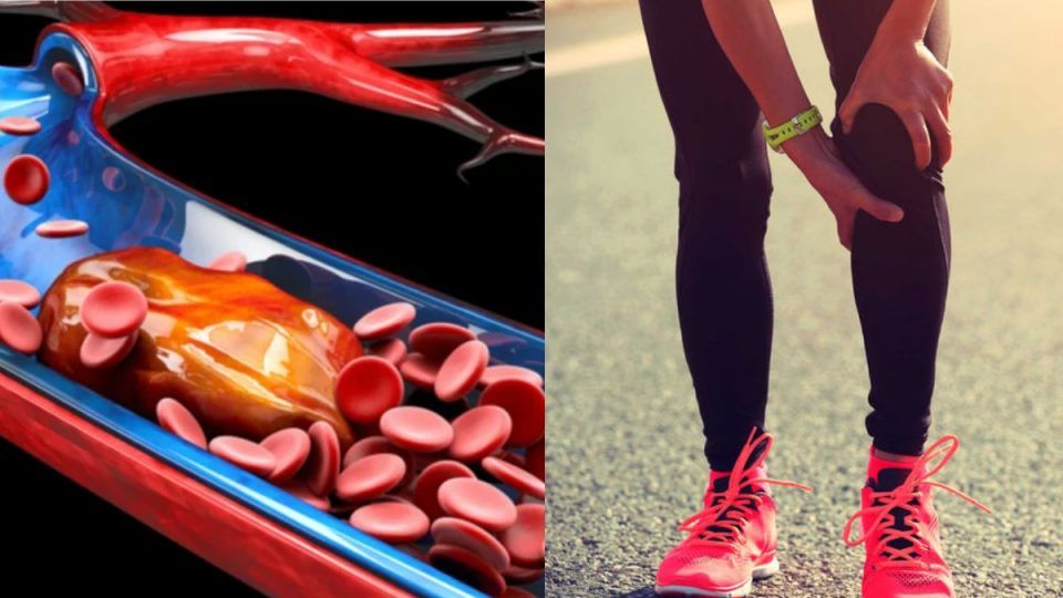 455107 thromvosi ti einai kai poia ta kyriotera simadia pou axizei na prosexete.jpg