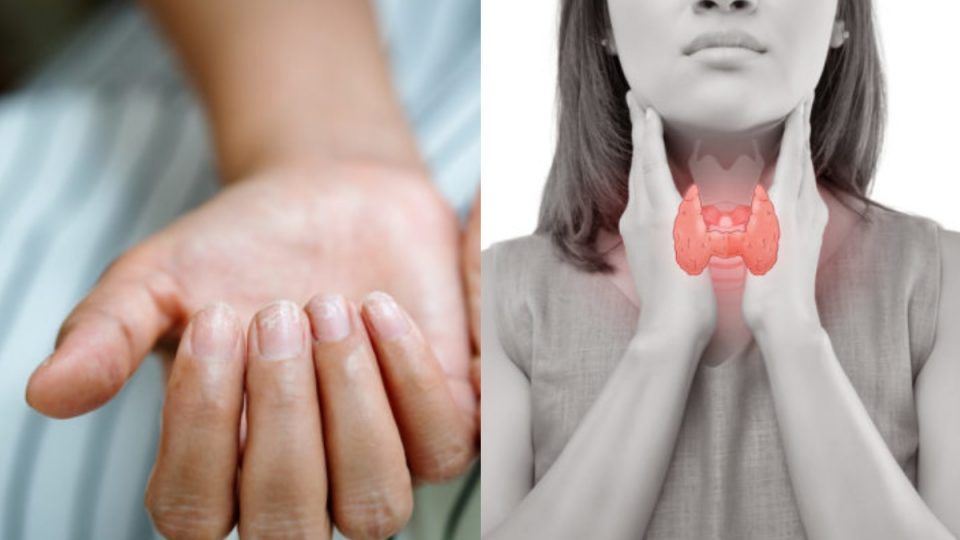 455125 thyreoeidis ta simadia sta nychia pou den dinoume simasia.jpg