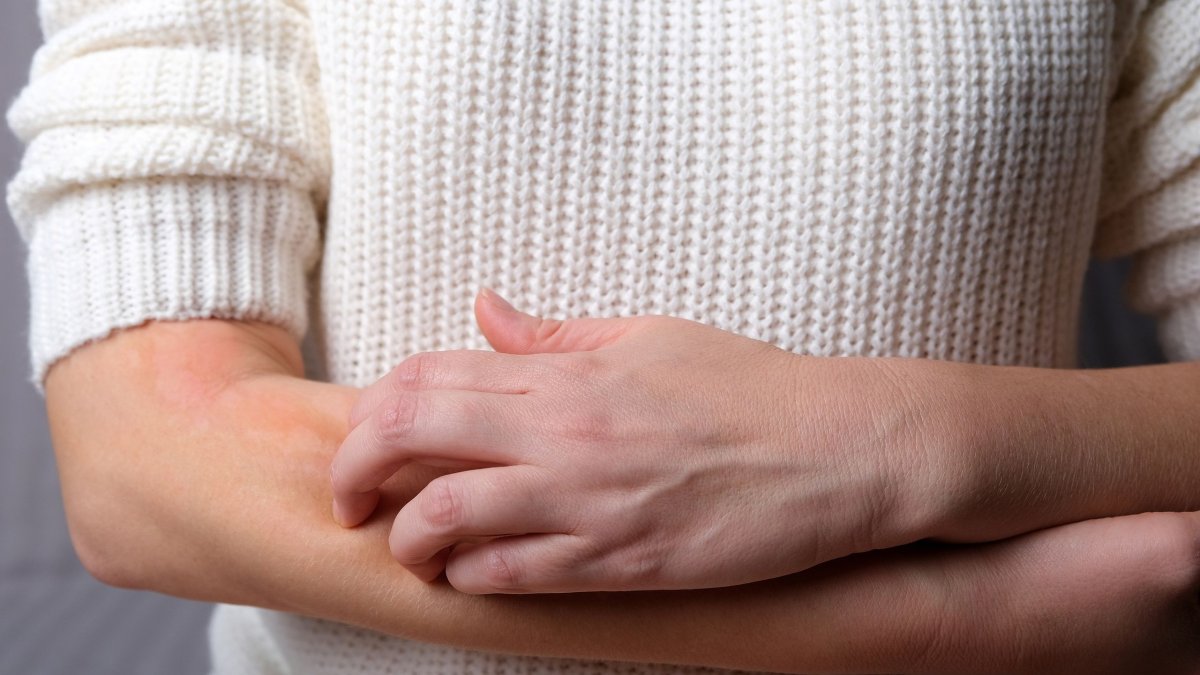 455205 exanthimata apo to agchos ti prepei na xerete.jpg