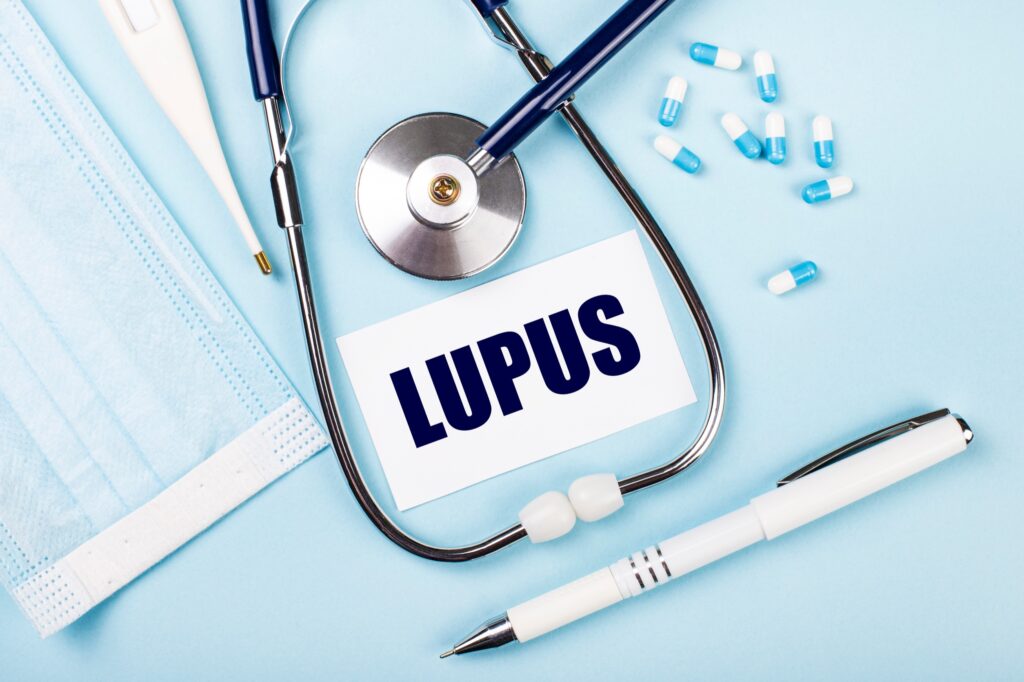 455694 erythimatodis lykos i aftoanosi astheneia pou prosvallei kata 90 tis gynaikes.jpg