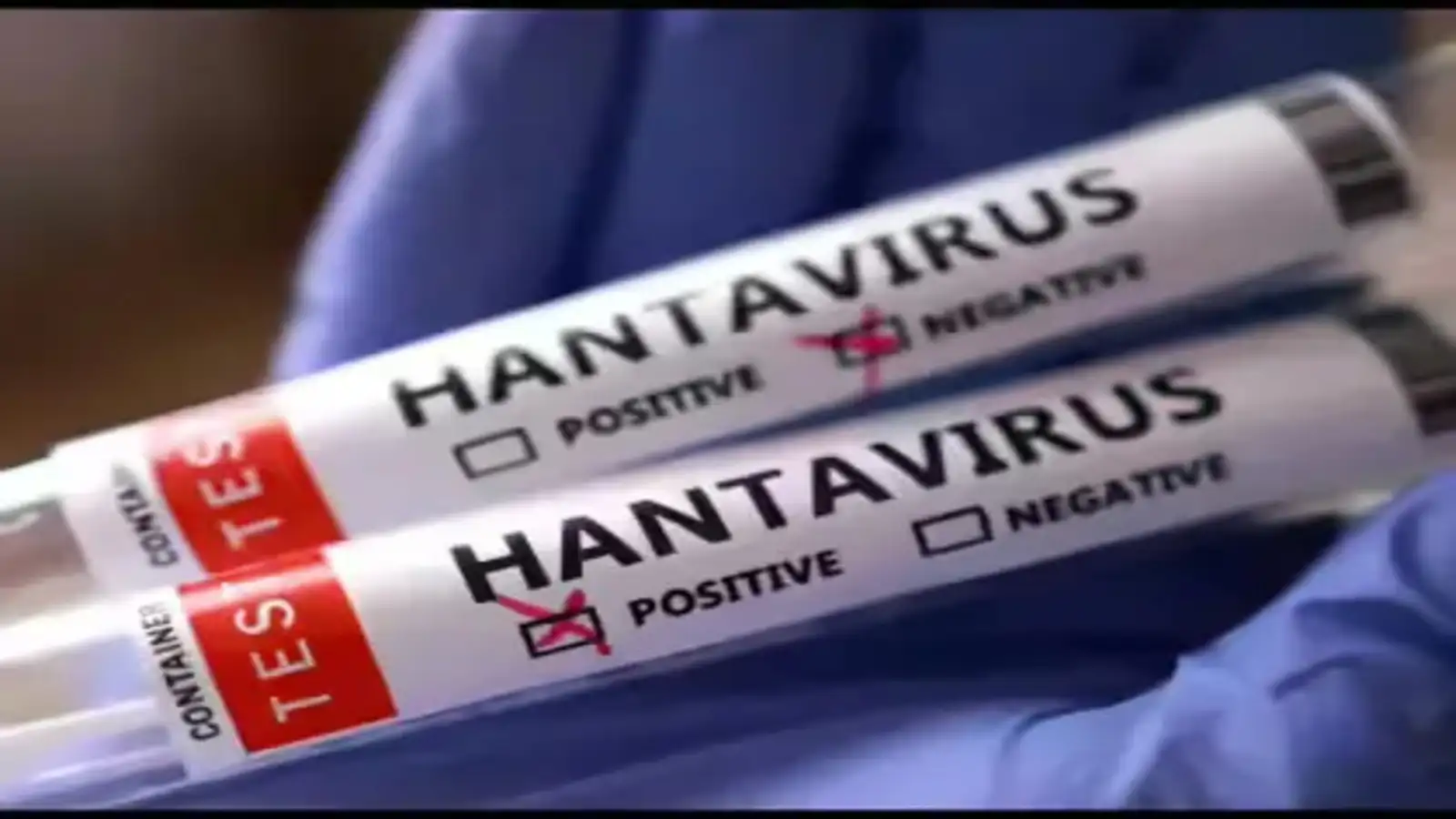 hantavirus outbreak on cruise ship india monitors situation no cases on indian soil.webp.webp