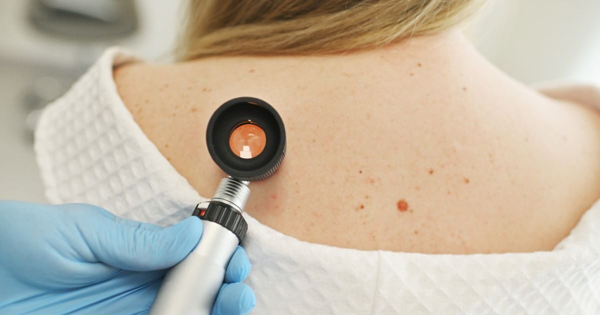 karkinosdermatos 1200x675 1 1200x630.jpg